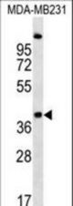 RQCD1 Antibody western blot of MDA-MB231 cell line lysates (35 ug/lane). The RQCD1 antibody detected the RQCD1 protein (arrow).