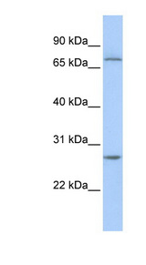 RCHY1 / PIRH2 antibody LS-C110735 Western blot of Jurkat lysate.