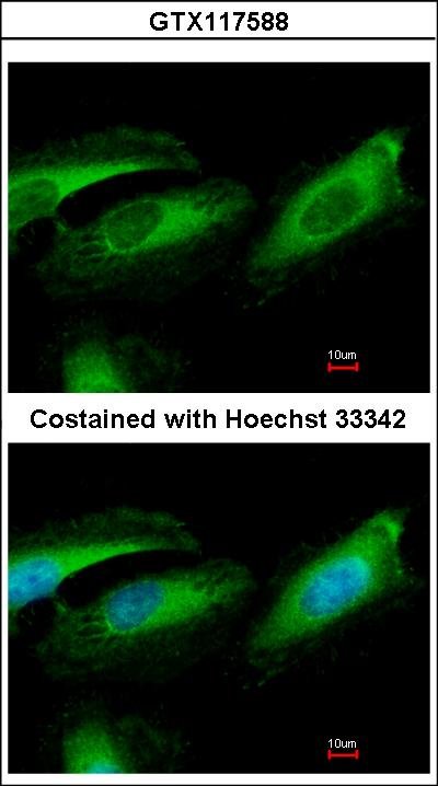 Immunofluorescence of paraformaldehyde-fixed HeLa, using Pirh2 antibody at 1:500 dilution.