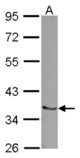 Sample (30 ug of whole cell lysate) A: NT2D1 10% SDS PAGE RCHY1 / PIRH2 antibody diluted at 1:1000