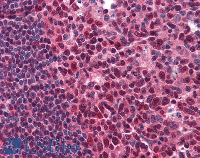 Anti-RCHY1 / PIRH2 antibody IHC of human tonsil. Immunohistochemistry of formalin-fixed, paraffin-embedded tissue after heat-induced antigen retrieval. Antibody LS-B4132 dilution 1:200.
