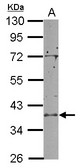 Sample (50 ug of whole cell lysate) A: mouse brain 10% SDS PAGE RCL1 antibody diluted at 1:10000