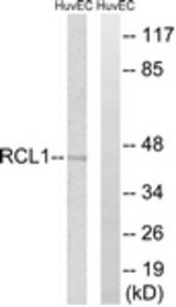 Western blot of extracts from HUVEC cells, using RCL1 Antibody. The lane on the right is treated with the synthesized peptide.