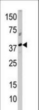 Western blot of anti-RCL1 antibody in A375 cell line lysate (35 ug/lane). RCL1(arrow) was detected using the purified antibody.