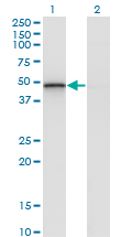 Western blot of RCN2 expression in transfected 293T cell line by RCN2 monoclonal antibody (M02), clone 1A9.