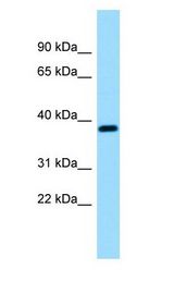 RCN3 antibody Western Blot of Fetal Brain.