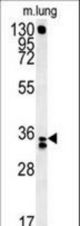 RCN3 Antibody western blot of mouse lung tissue lysates (15 ug/lane). The RCN3 antibody detected RCN3 protein (arrow).