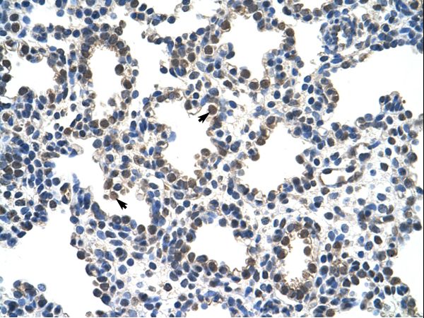 RCOR1 / COREST antibody LS-C31778 was used in IHC to stain formalin-fixed, paraffin-embedded human lung.