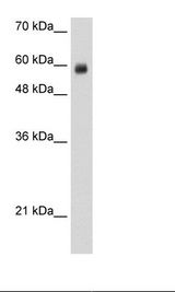 Jurkat Cell Lysate