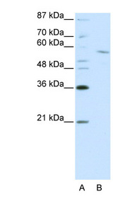 RCOR1 / COREST antibody LS-B1559 Western blot of Jurkat lysate.