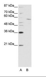 Jurkat Cell Lysate