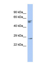 RD3 antibody LS-C111723 Western blot of Fetal Brain lysate.