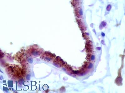 Anti-RDH1 / RDH5 antibody IHC staining of human eye, retina. Immunohistochemistry of formalin-fixed, paraffin-embedded tissue after heat-induced antigen retrieval. Antibody LS-B9519 concentration 5 ug/ml.