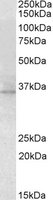 RDH5 antibody (2 ug/ml) staining of Mouse Eye lysate (35 ug protein/ml in RIPA buffer). Primary incubation was 1 hour. Detected by chemiluminescence.