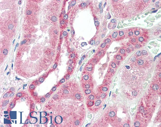 Anti-RDH10 antibody IHC staining of human kidney. Immunohistochemistry of formalin-fixed, paraffin-embedded tissue after heat-induced antigen retrieval. Antibody LS-B9749 concentration 10 ug/ml.