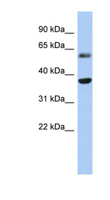RDH10 antibody Western blot of Fetal Heart lysate.