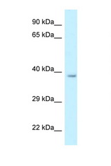 RDH10 antibody LS-C145706 Western blot of Rat Liver lysate. Antibody concentration 1 ug/ml.
