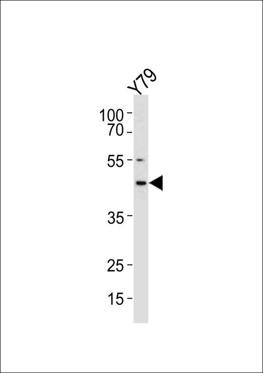 RDH10 Antibody western blot of Y79 cell line lysates (35 ug/lane). The RDH10 antibody detected the RDH10 protein (arrow).