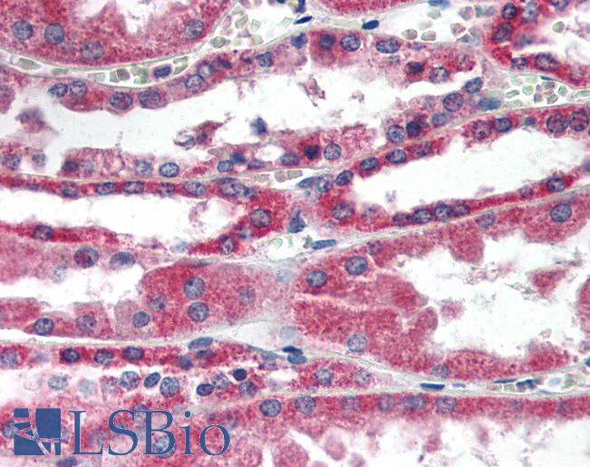 Anti-RDH11 antibody IHC of human kidney. Immunohistochemistry of formalin-fixed, paraffin-embedded tissue after heat-induced antigen retrieval. Antibody LS-B2363 concentration 5 ug/ml.