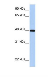 Fetal heart lysate. Antibody concentration: 1.0 ug/ml. Gel concentration: 12%.