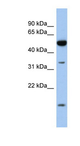 RDH12 antibody LS-C111452 Western blot of Fetal Intestine lysate.