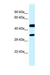 RDH13 antibody LS-C145791 Western blot of Fetal Kidney lysate. Antibody concentration 1 ug/ml.