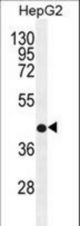 RDH13 Antibody western blot of HepG2 cell line lysates (35 ug/lane). The RDH13 antibody detected the RDH13 protein (arrow).