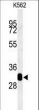 RDH16 Antibody western blot of K562 cell line lysates (35 ug/lane). The RDH16 antibody detected the RDH16 protein (arrow).