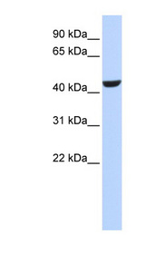 RDH16 antibody LS-C101945 Western blot of 721_B cell lysate.