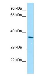 RDH8 antibody Western Blot of A549.
