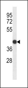 SDR16C5 Antibody western blot of HepG2 cell line lysates (35 ug/lane). The SDR16C5 antibody detected the SDR16C5 protein (arrow).