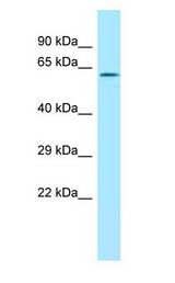 RDX / Radixin antibody Western Blot of Mouse Small Intestine.
