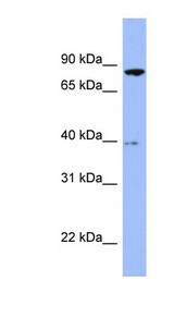 RDX / Radixin antibody LS-C107531 Western blot of Fetal Brain lysate.