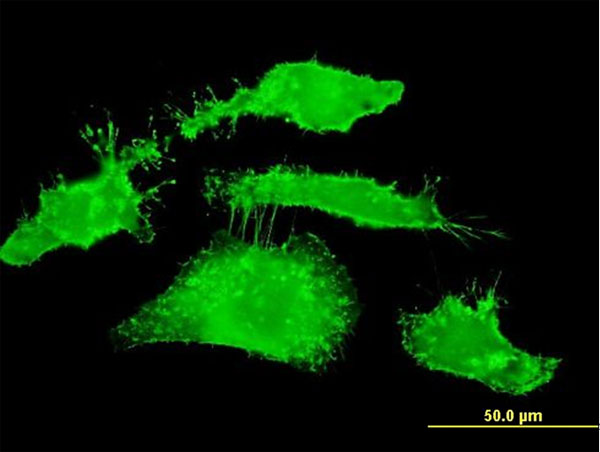 Immunofluorescence of monoclonal antibody to RDX on HeLa cell . [antibody concentration 10 ug/ml]