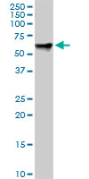 RDX monoclonal antibody (M01), clone 1E12. Western Blot analysis of RDX expression in human kidney.