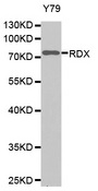 Western blot analysis of extracts of Y79 cell line, using RDX antibody.