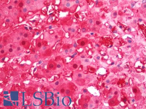 Anti-RDX / Radixin antibody IHC staining of human adrenal. Immunohistochemistry of formalin-fixed, paraffin-embedded tissue after heat-induced antigen retrieval. Antibody LS-B11385 concentration 5 ug/ml.