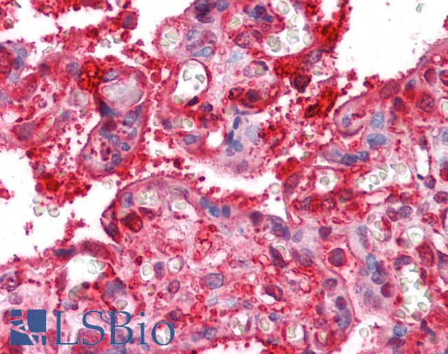 Anti-Radixin antibody IHC of human placenta. Immunohistochemistry of formalin-fixed, paraffin-embedded tissue after heat-induced antigen retrieval. Antibody LS-B4336 concentration 2.5 ug/ml.