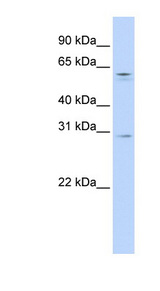 REC8 antibody LS-C102282 Western blot of 721_B cell lysate.