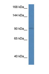 RECK antibody LS-C145245 Western blot of Mouse Spleen lysate. Antibody concentration 1 ug/ml.