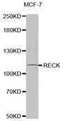 Western blot analysis of extracts of MCF7 cells tissue, using RECK antibody.