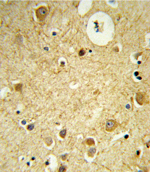 Formalin-fixed and paraffin-embedded human brain tissue reacted with RECK Antibody , which was peroxidase-conjugated to the secondary antibody, followed by DAB staining. This data demonstrates the use of this antibody for immunohistochemistry; clinical relevance has not been evaluated.