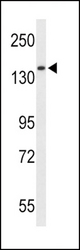 Western blot of RECK Antibody in HepG2 cell line lysates (35 ug/lane). RECK (arrow) was detected using the purified antibody.