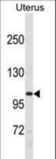 RECQL5 Antibody western blot of human Uterus tissue lysates (35 ug/lane). The RECQL5 antibody detected the RECQL5 protein (arrow).