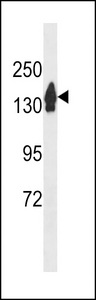 RECQL4 Antibody western blot of mouse testis tissue lysates (35 ug/lane). The RECQL4 antibody detected the RECQL4 protein (arrow).