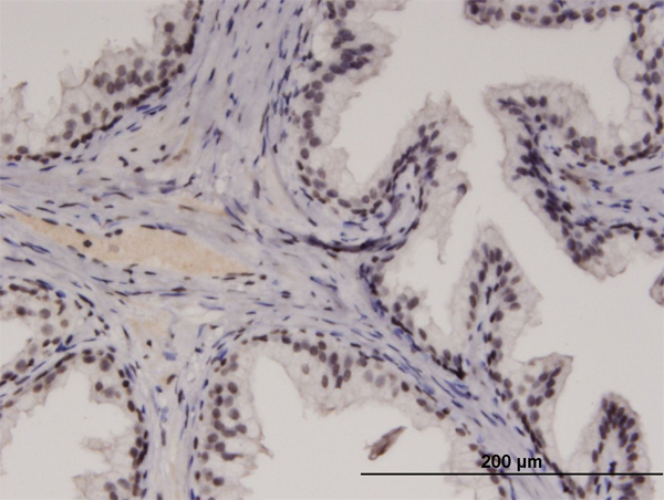 Immunoperoxidase of monoclonal antibody to RECQL4 on formalin-fixed paraffin-embedded human prostate. [antibody concentration 3 ug/ml]