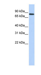ADARB2 / RED2 antibody LS-C101878 Western blot of Fetal Heart lysate.
