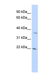 DDIT4L antibody LS-C102477 Western blot of 293T cell lysate.
