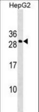 DDIT4L Antibody western blot of HepG2 cell line lysates (35 ug/lane). The DDIT4L antibody detected the DDIT4L protein (arrow).