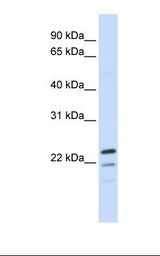 Fetal brain lysate. Antibody concentration: 1.0 ug/ml. Gel concentration: 12%.